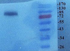 Elastin Rabbit Polyclonal Antibody