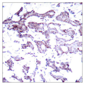 ELK1 Antibody