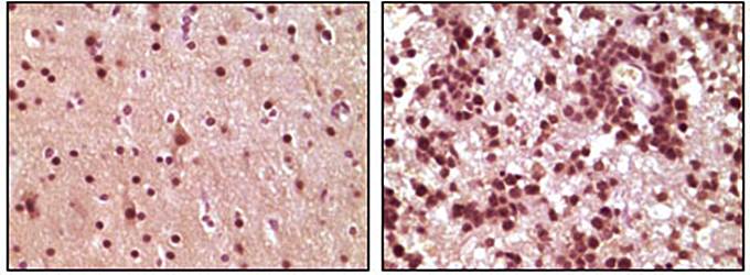 ELK1 Antibody