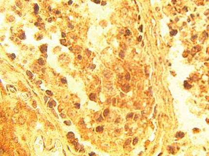 Rabbit anti Human ELOVL4 Antibody