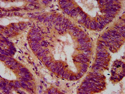 ELP2 Antibody