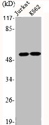 ADGRE4P Antibody