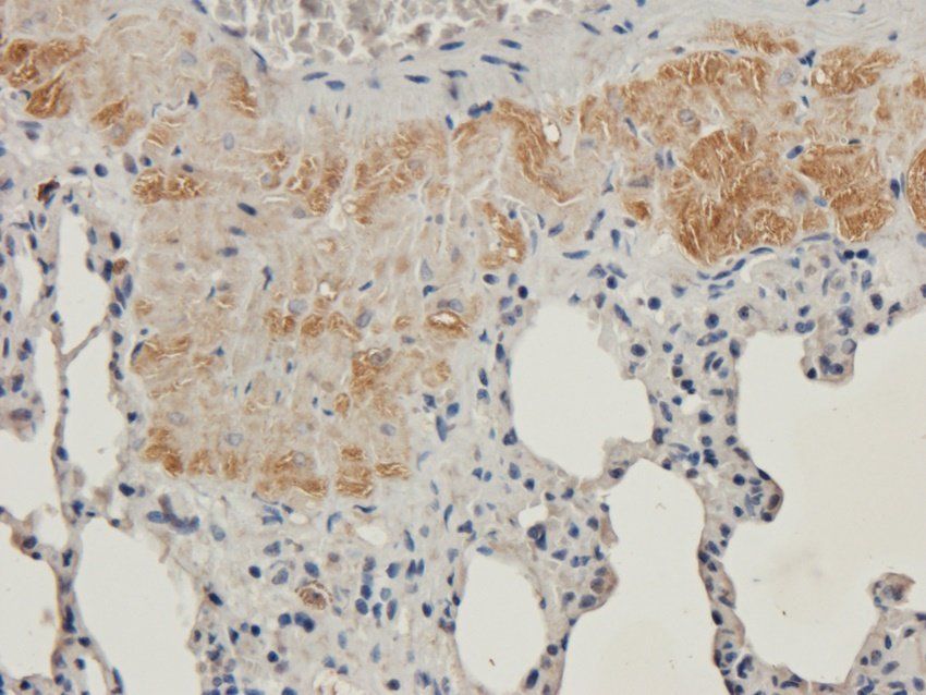 ENaC Alpha Rabbit Polyclonal Antibody