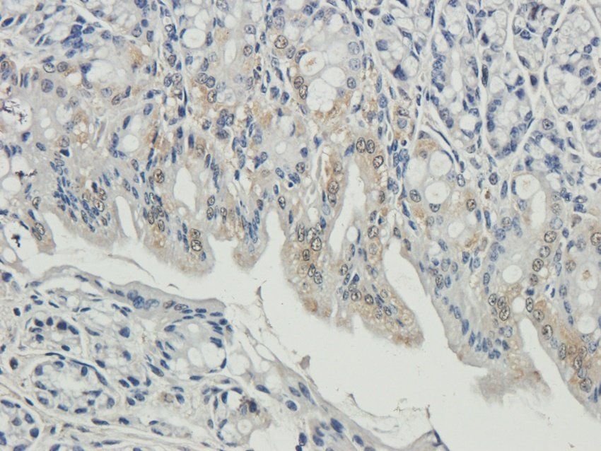 ENaC gamma Rabbit Polyclonal Antibody