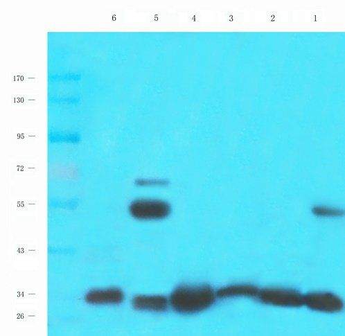 ENaC gamma Rabbit Polyclonal Antibody