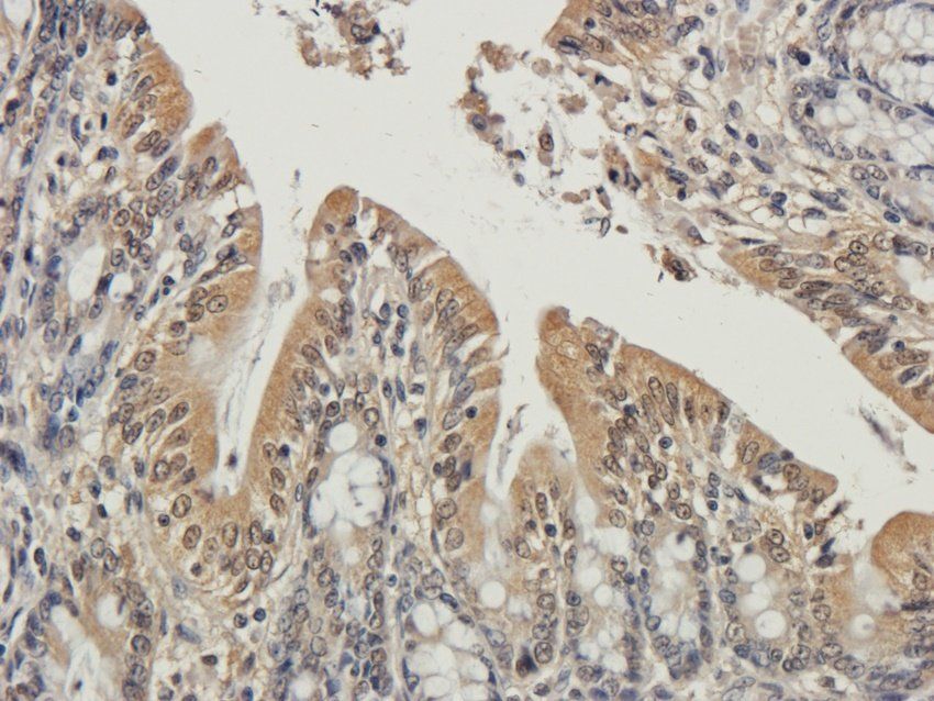 Enkephalin Rabbit Polyclonal Antibody