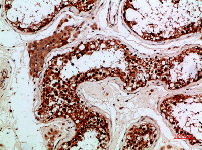 PENK Antibody