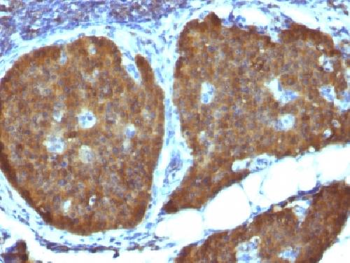 ENO2 Antibody