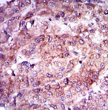 ENO2 Antibody
