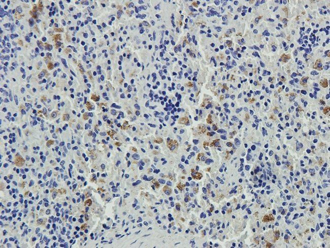 ENPP1 Rabbit Polyclonal Antibody