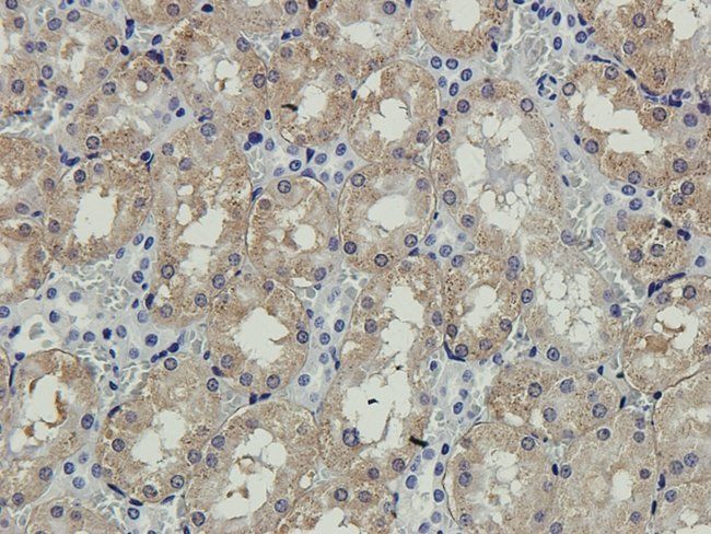 ENPP1 Rabbit Polyclonal Antibody