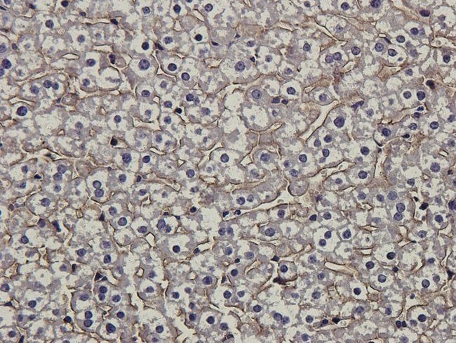 ENPP1 Rabbit Polyclonal Antibody