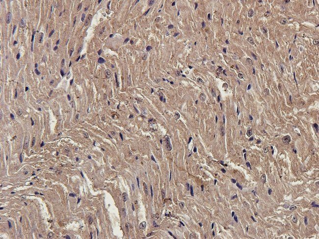 ENPP1 Rabbit Polyclonal Antibody