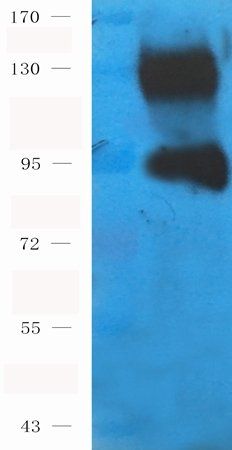 ENPP1 Rabbit Polyclonal Antibody