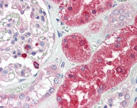 ENTPD5 Rabbit Polyclonal Antibody