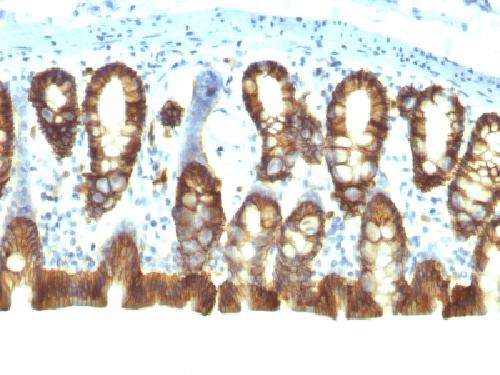 EPCAM Antibody