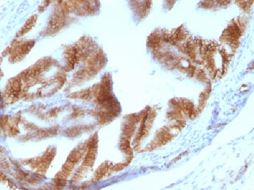 EPCAM Antibody