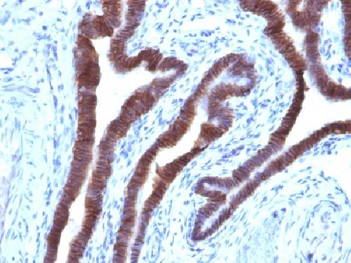 EPCAM Antibody