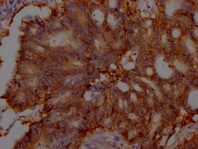EPCAM Antibody