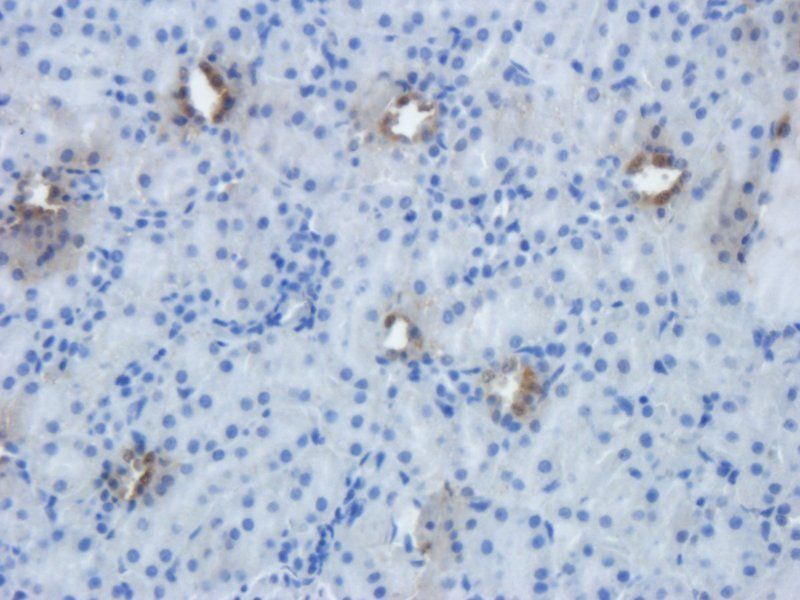 EpCAM Rabbit Polyclonal Antibody