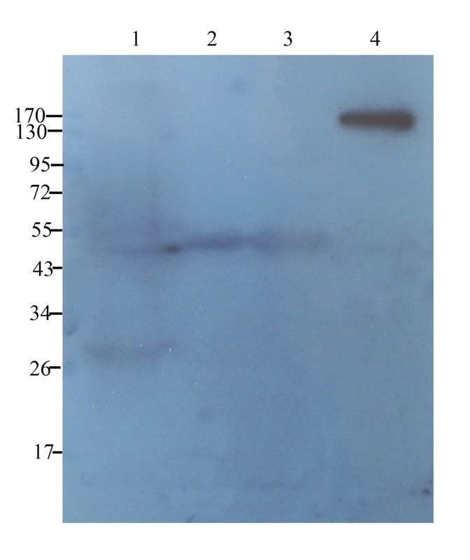 EpCAM Rabbit Polyclonal Antibody