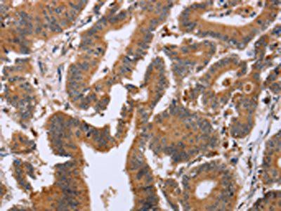 EPDR1 Antibody