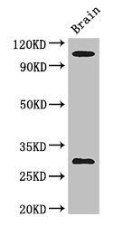 EPHA1 Antibody