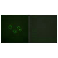 EPHA2/EPHA3/EPHA4 Antibody