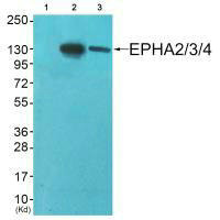 EPHA2/EPHA3/EPHA4 Antibody