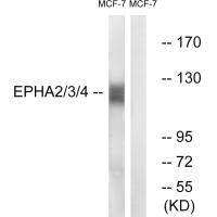 EPHA2/EPHA3/EPHA4 Antibody