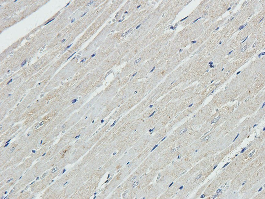 EPHA4 Rabbit Polyclonal Antibody