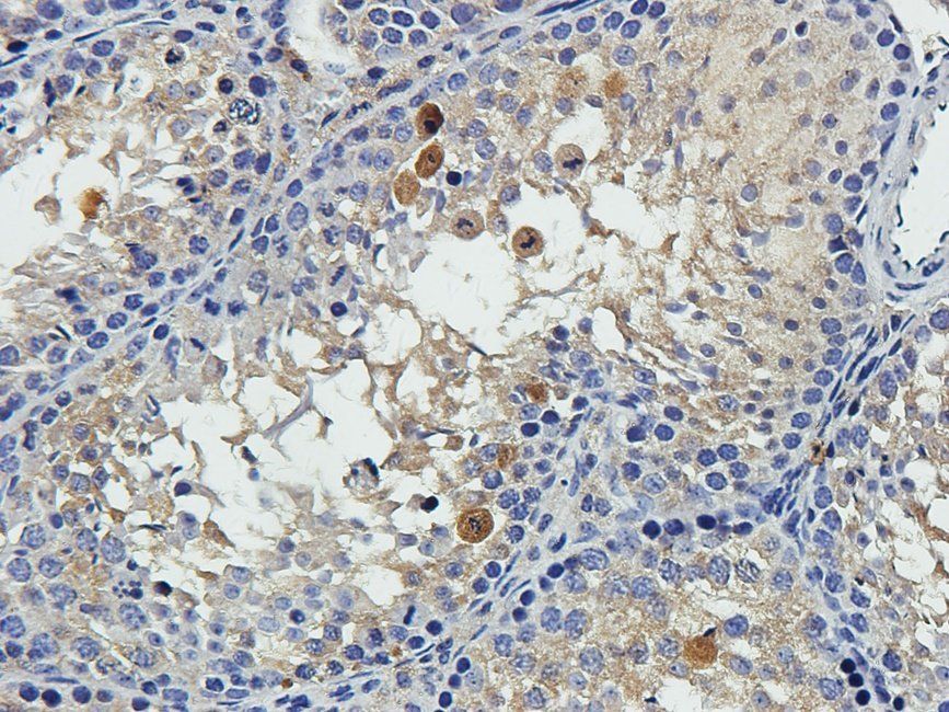 EPHA4 Rabbit Polyclonal Antibody
