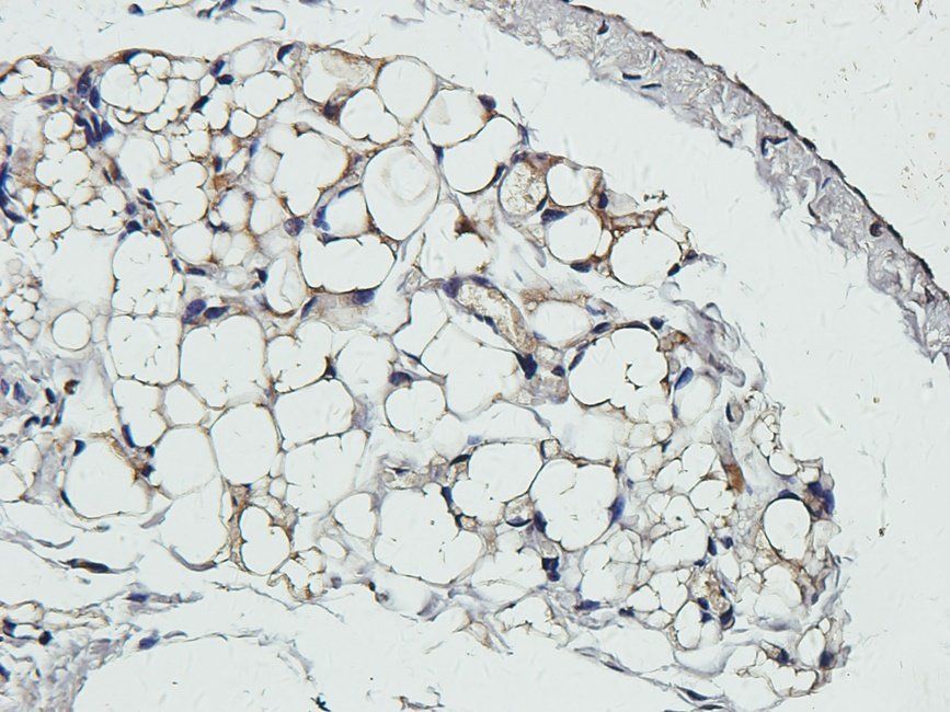 EPHA4 Rabbit Polyclonal Antibody