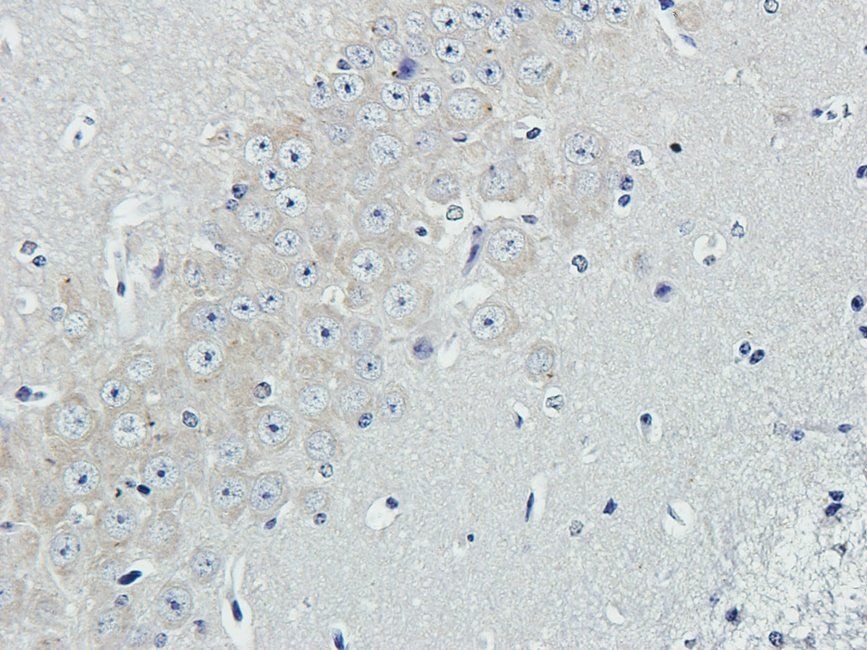 EPHA4 Rabbit Polyclonal Antibody