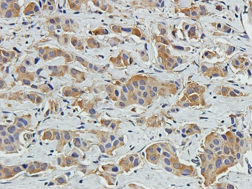 EPHA4 Rabbit Polyclonal Antibody