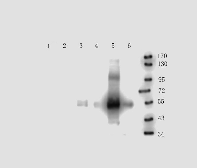 EPHA4 Rabbit Polyclonal Antibody