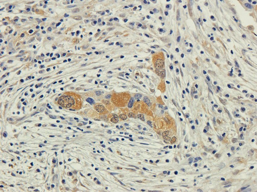 EPOR Rabbit Polyclonal Antibody