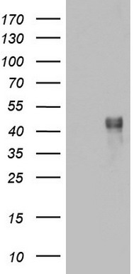 Epoxide hydrolase Antibody