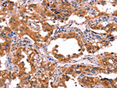 ERAS Antibody