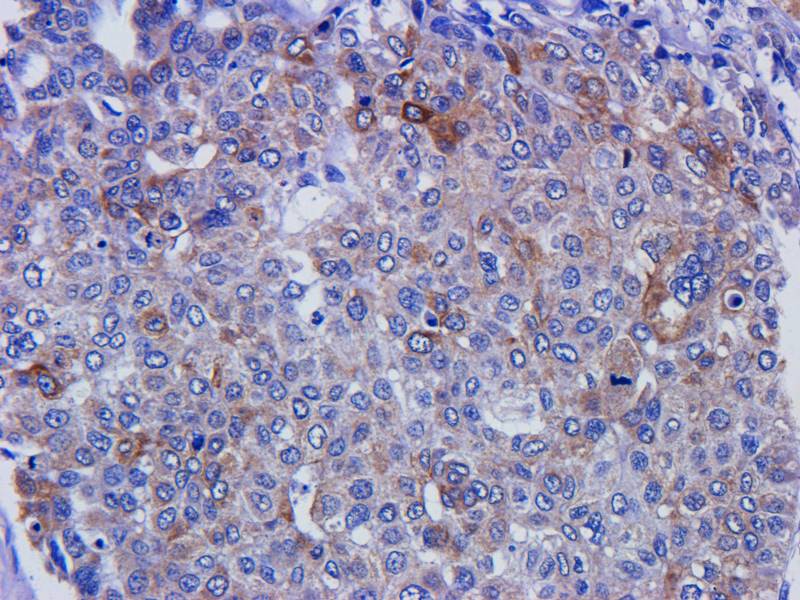 EREG Rabbit Polyclonal Antibody