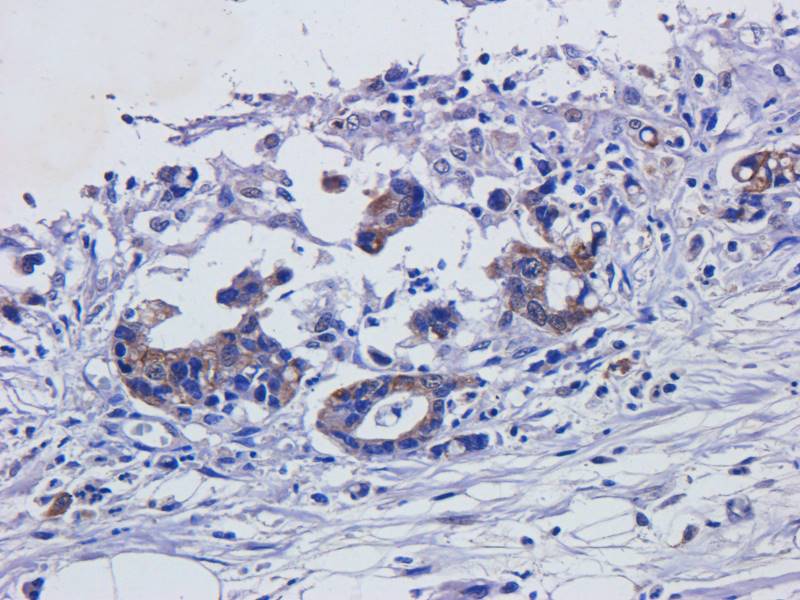 EREG Rabbit Polyclonal Antibody
