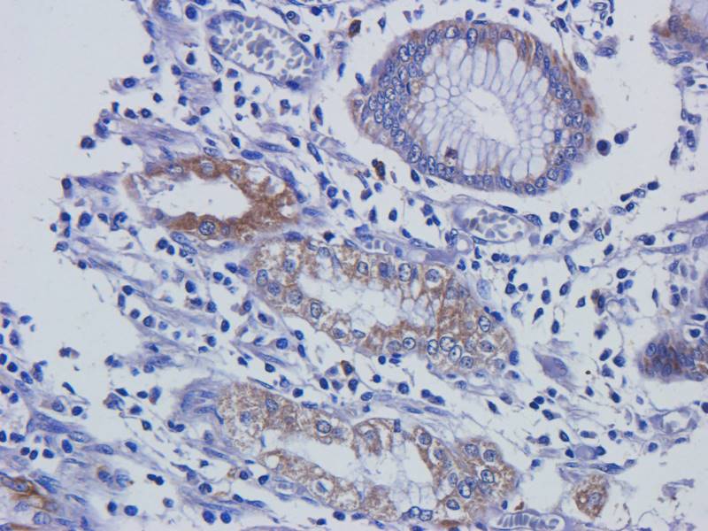EREG Rabbit Polyclonal Antibody