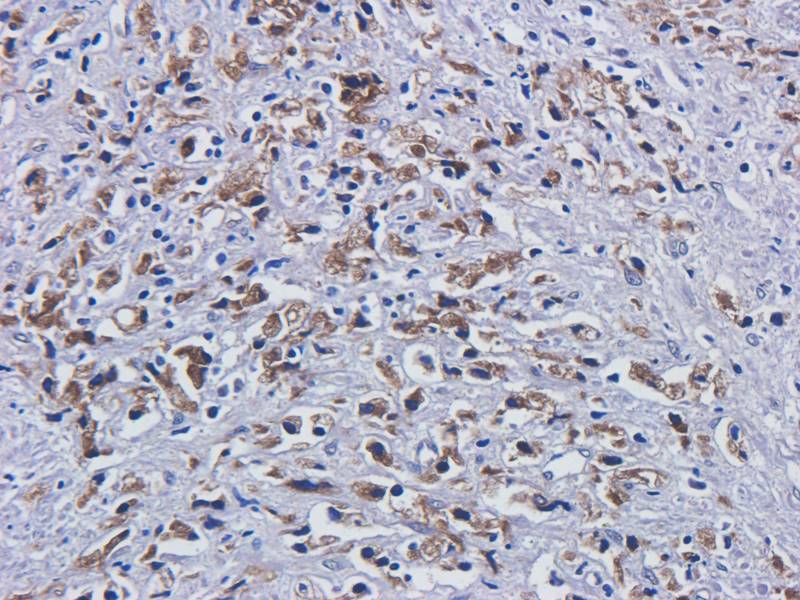 EREG Rabbit Polyclonal Antibody