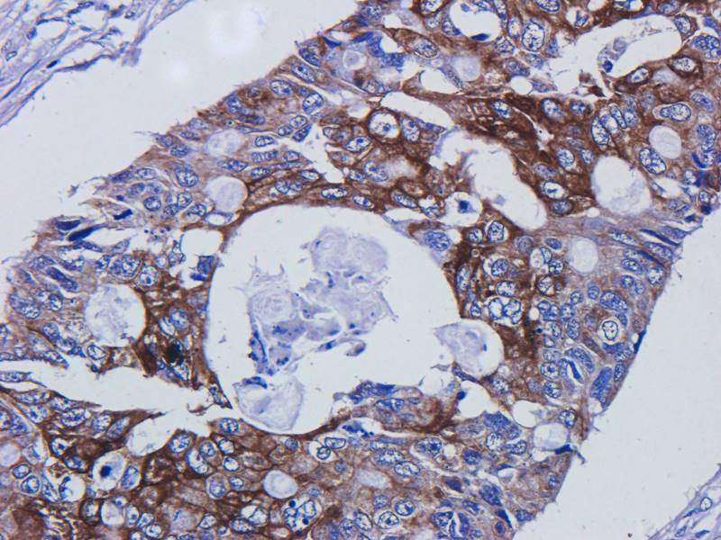 EREG Rabbit Polyclonal Antibody