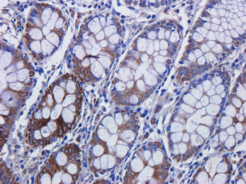 EREG Rabbit Polyclonal Antibody