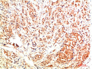 MAPK3 Antibody