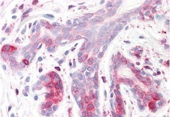 SPFH2/ERLIN2 Antibody