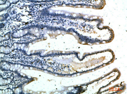 SELE Antibody