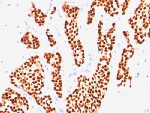 ESR1 Antibody