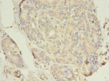 ESR1 Antibody